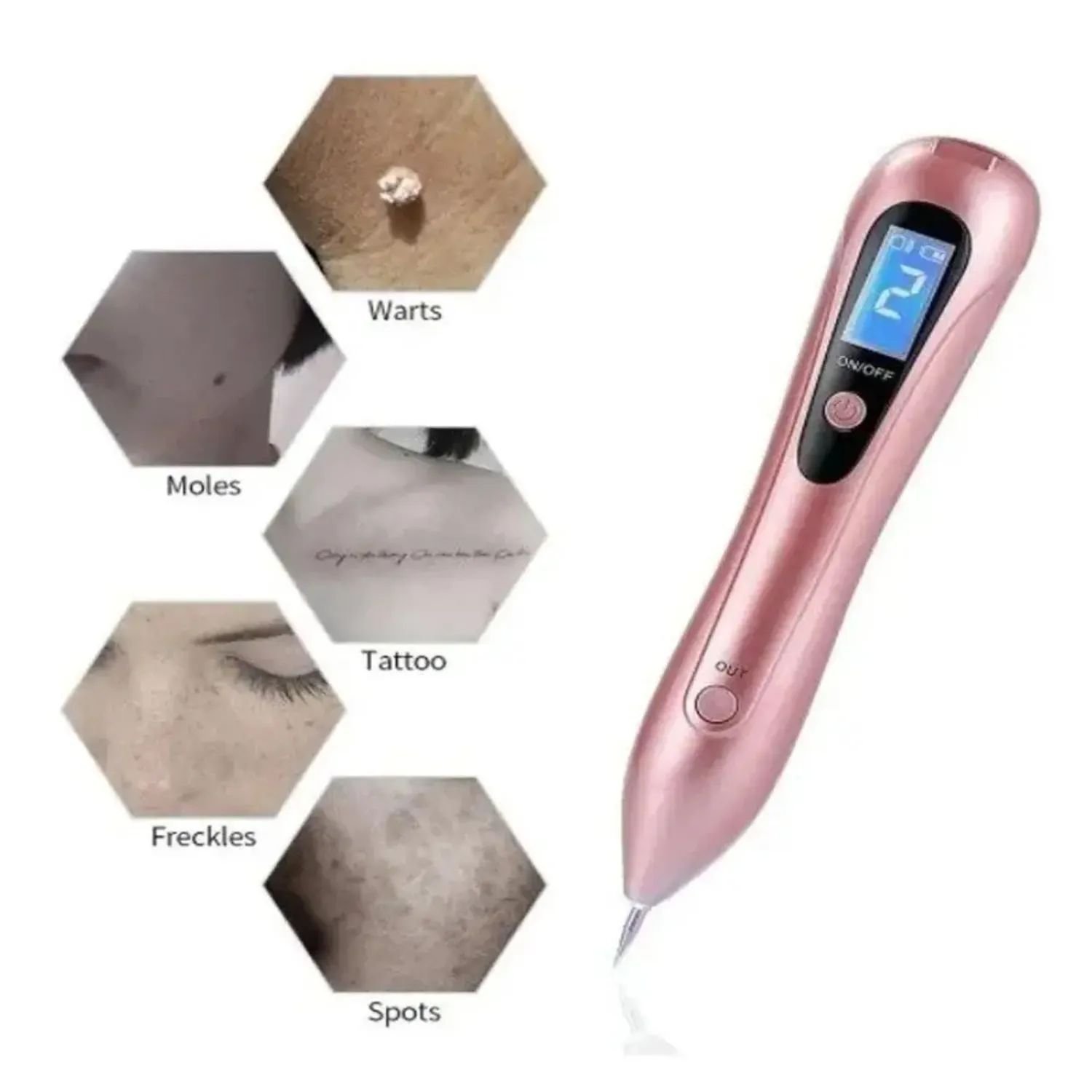 Cauterizador Luz + 5agujas 998-4 - Imagen 3